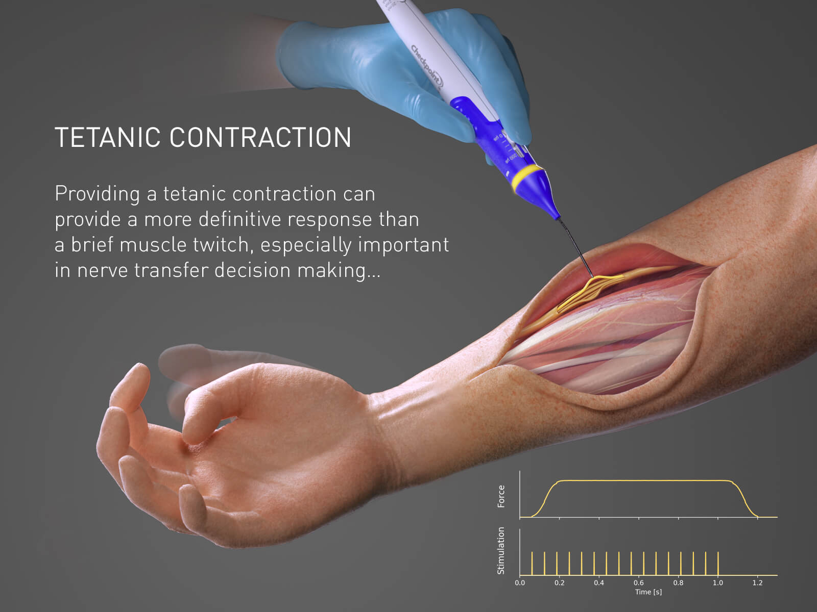 What Is A Tetanic Contraction In Anatomy